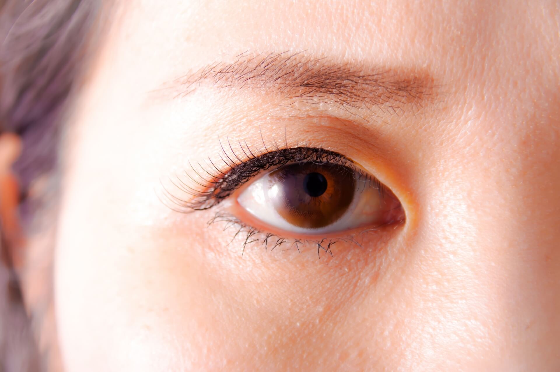 二重整形でハム目が起こる原因