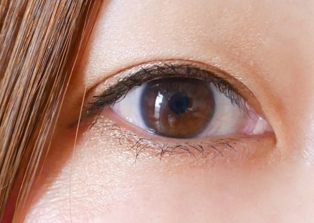 余分な脂肪を切除して理想のラインをデザイン